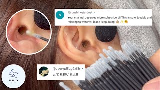 ASMR  ミクロスワブで最高の耳かき体験  Best Ear Cleaning Experience With Micro Swabs [upl. by Frederique]