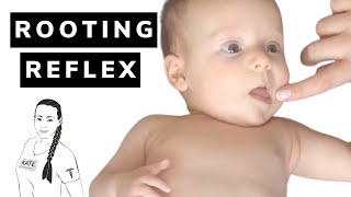 Rooting reflex in babies [upl. by Chloe]