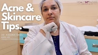 Acne Skin Care Tips by Dr Ashima Goel  Best Dermatologist In Chandigarh  HealthFinder [upl. by Selinda209]