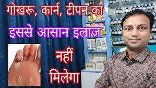 गोखरू कार्न टीपन ठीक करने का आसान तरीका best medicine for corn how to cure corns easily in hindi [upl. by Bertrand]