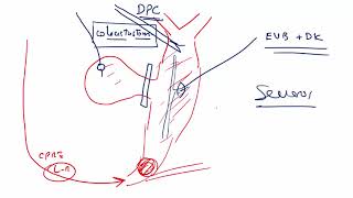 4 COLANGITIS PERITONITIS ABDOM AGUDO VASCULAR [upl. by Nikolaus]