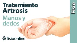 Tratamiento de fisioterapia para la artrosis de manos y dedos [upl. by Yedoc]