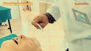 Nasopharyngeal Airway insertion [upl. by Ebehp]