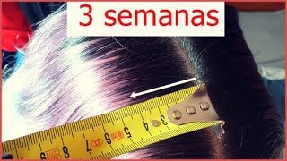 Cómo acelerar el crecimiento del cabello ¡¡ HASTA 4 CM EN 3 SEMANAS [upl. by Ahsener]