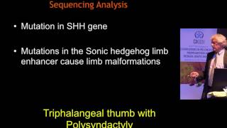 From Fetal CMA to Fetal Exomes  Ron Wapner [upl. by Bromley]