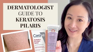 Dermatologist Guide to KP  Keratosis Pilaris Chicken Skin [upl. by Samanthia]