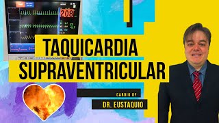 TAQUICARDIA SUPRAVENTRICULAR O Que É É Grave  Dr Eustáquio Ferreira Neto [upl. by Noremak]