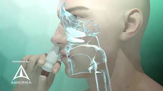 Fluticasone nasal spray Flonase  3D medical animation [upl. by Clemens]