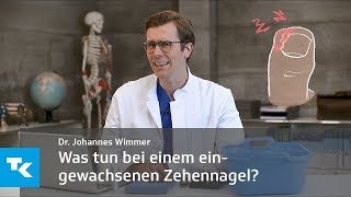 Was tun bei einem eingewachsenen Zehennagel  Dr Johannes Wimmer [upl. by Michaeline477]