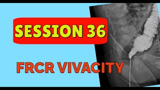 FRCR VIVACITY SESSION 36 [upl. by Collis]