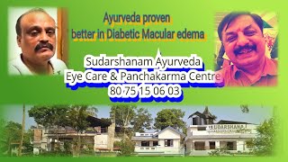 Bengaluru Diabetic Macular edema vision improved in AYURVEDASudarshanam [upl. by Seabrooke930]