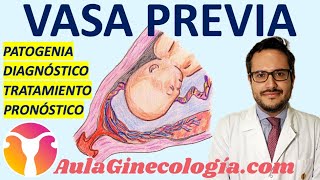 🩸 VASA PREVIA⚡ PATOGENIA DIAGNÓSTICO TRATAMIENTO PRONÓSTICO👶🏼  Ginecología y Obstetricia [upl. by Pammie93]