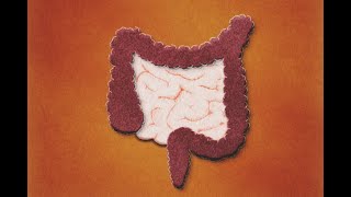 Patología Isquémica Intestinal Definición Evaluación Tratamiento [upl. by Derf507]