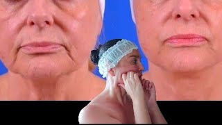 Lymphatic Drainage Massage  Lifting Sculpting Massage How To Combine 2 Massage Techniques [upl. by Cadal274]