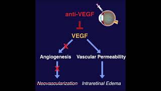 AntiVEGF for the treatment of Retinal Diseases  ANCHOR MARINA BRAVO CRUISE DRCR Protocol I [upl. by Juster]