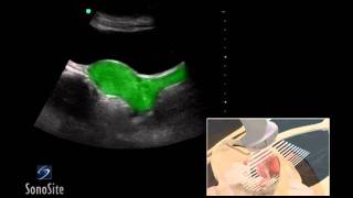 How To Female Pelvis Ultrasound Exam 3D Video [upl. by Sivad]