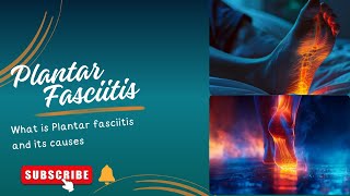 What is Plantar Fasciitis and its Causes [upl. by Petromilli]