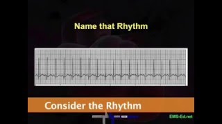 Intro EKG Interpretation Part 2 [upl. by Norina219]