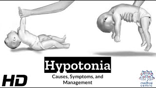 Hypotonia Explained What You Need to Know [upl. by Anyaj]