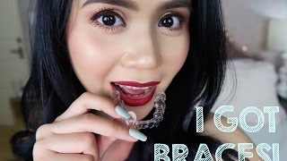 Invisalign Update1 I GOT BRACES  Anna Cay ♥ [upl. by Fidelia]