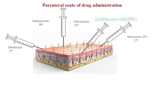 Parenteral routePart 2Routes of Drug administration pharmacology pharmacy [upl. by Henarat]