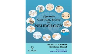 Signature Signs in Neurology Chapter 55 video 3 Opsoclonus Myoclonus Ataxia syndrome OMAS [upl. by Peggy762]