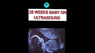 28 weeks baby on ultrasound pregnant ultrasound pregnancare [upl. by Htiderem]