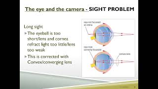 KS3 Eyes and vision lesson Function of parts of eye and eye problems [upl. by Macmillan572]