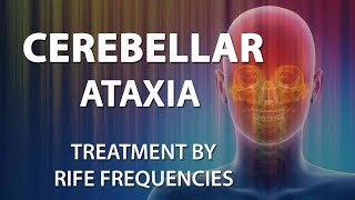 Cerebellar Ataxia  RIFE Frequencies Treatment  Energy amp Quantum Medicine with Bioresonance [upl. by Zach321]