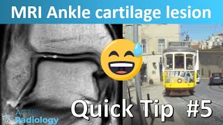 Tram Track Lesion on Ankle MRI MSK Quick Tip [upl. by Nilhtac215]