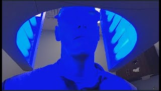 PHOTODYNAMIC THERAPY ”BLUE LIGHT” Im getting my face burned off [upl. by Hakan]