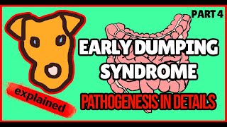 Early Dumping Syndrome pathogenesis Mechanism of clinical symptoms [upl. by Ert]