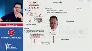 OTORRINOLARINGOLOGÍA Rinología Rinosinusitis [upl. by Goodwin253]