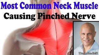 Most Common Neck Muscle That Causes Pinched Nerve  Dr Alan Mandell DC [upl. by Esirec]