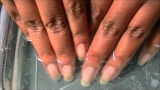 How to Whiten Nails in Minutes with Denture Tablets [upl. by Kcaz]