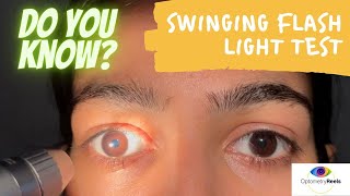 Swinging flash light test II How to examine RAPD II Assess relative afferent pupillary defect [upl. by Hudis]