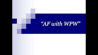 ECG Tip 22 What about AF with WPW [upl. by Purity14]