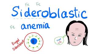 Sideroblastic Anemia [upl. by Maurili]