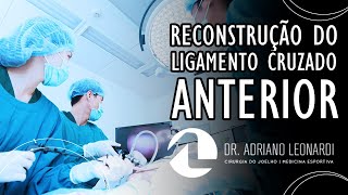 RECONSTRUÇÃO DO LIGAMENTO CRUZADO ANTERIOR  Dr Adriano Leonardi [upl. by Wan]