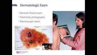 Melanoma Introduction to Evolution Diagnosis amp Treatment [upl. by Yellat806]