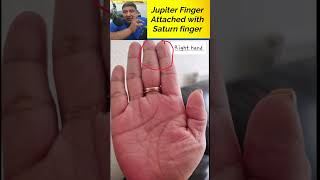 Jupiter Finger Attached with Saturn Finger  Signs of Dependency in Palmistry [upl. by Ayn]