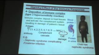 DrAzza Immunology of parasitic infection 1  parasite immune evasion [upl. by Yoral67]