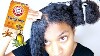 DIY Baking Soda Scalp Treatment For Clariyifing  Natural Hair Growth [upl. by Hughmanick]