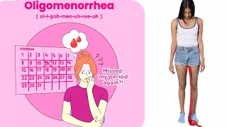 oligomenorrhea  oligomenorrhea causes [upl. by Alveta]