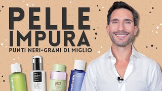 PELLE IMPURA PUNTI NERI E GRANI DI MIGLIO [upl. by Bannerman]