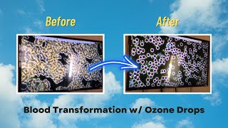 Unbelievable Blood Transformation in Minutes with Ozone Drops 2 [upl. by Anilemrac]