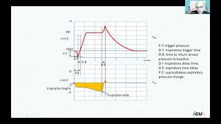 Double triggering and asynchrony on mechanical ventilation [upl. by Dazhehs493]