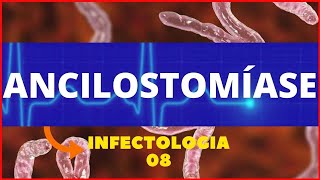 ANCILOSTOMÍASE AMARELÃO  ANCYLOSTOMA DUODENALE  PARASITOLOGIA  INFECTOLOGIA [upl. by Adnamma]