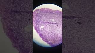 TS of Blastula permanent slide [upl. by Elletsirhc]