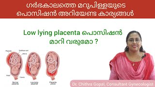 Placenta position during pregnancy malayalam drchithra placenta [upl. by Edas239]